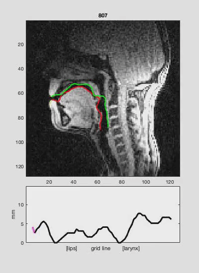 charlotte wiltshire's research using vocal tract MRI