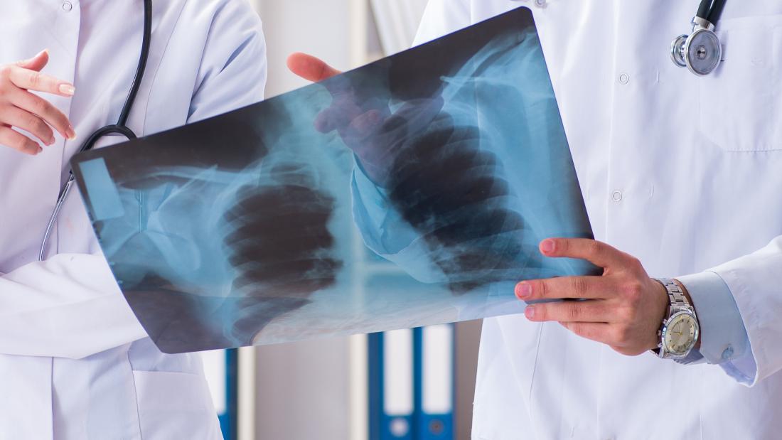 Two nurses looking at x-rays