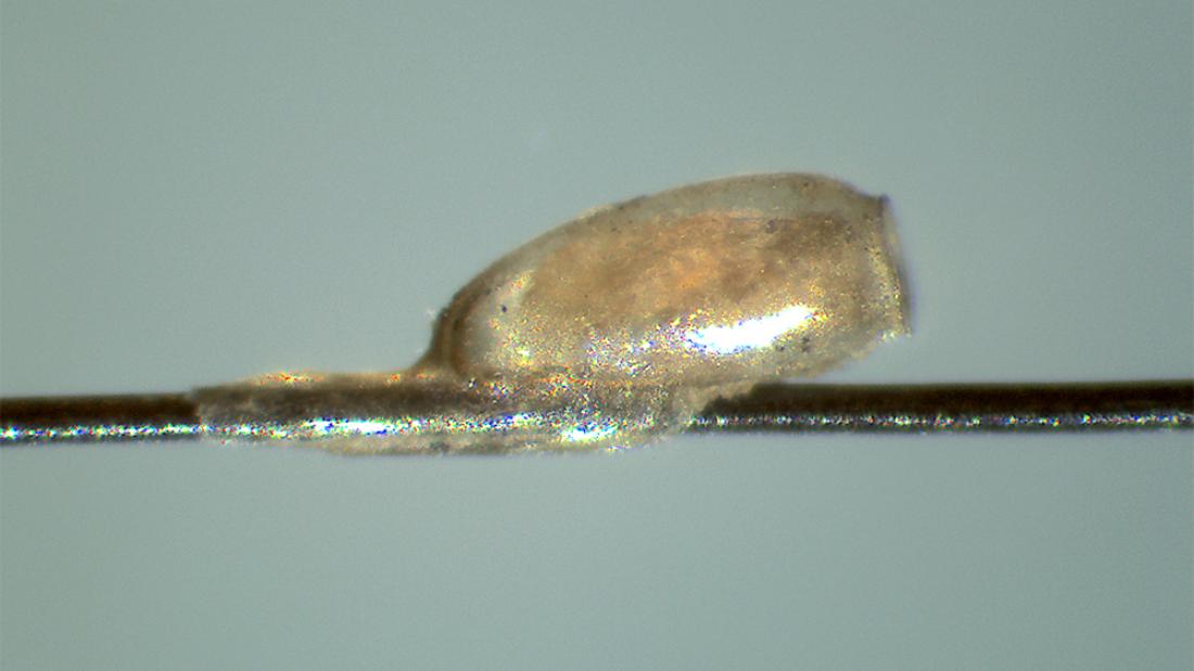 A nit attached to a human hair