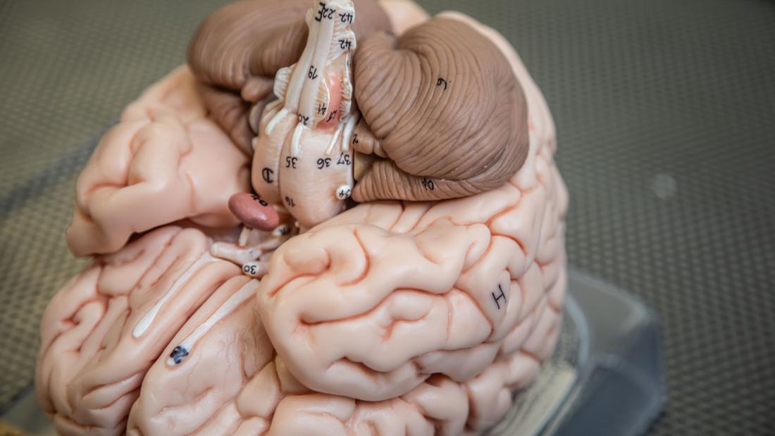 A model of a brain