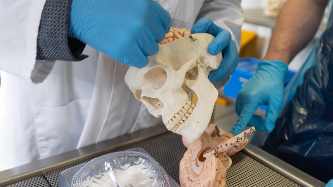 a prosthetic skull and brain close up