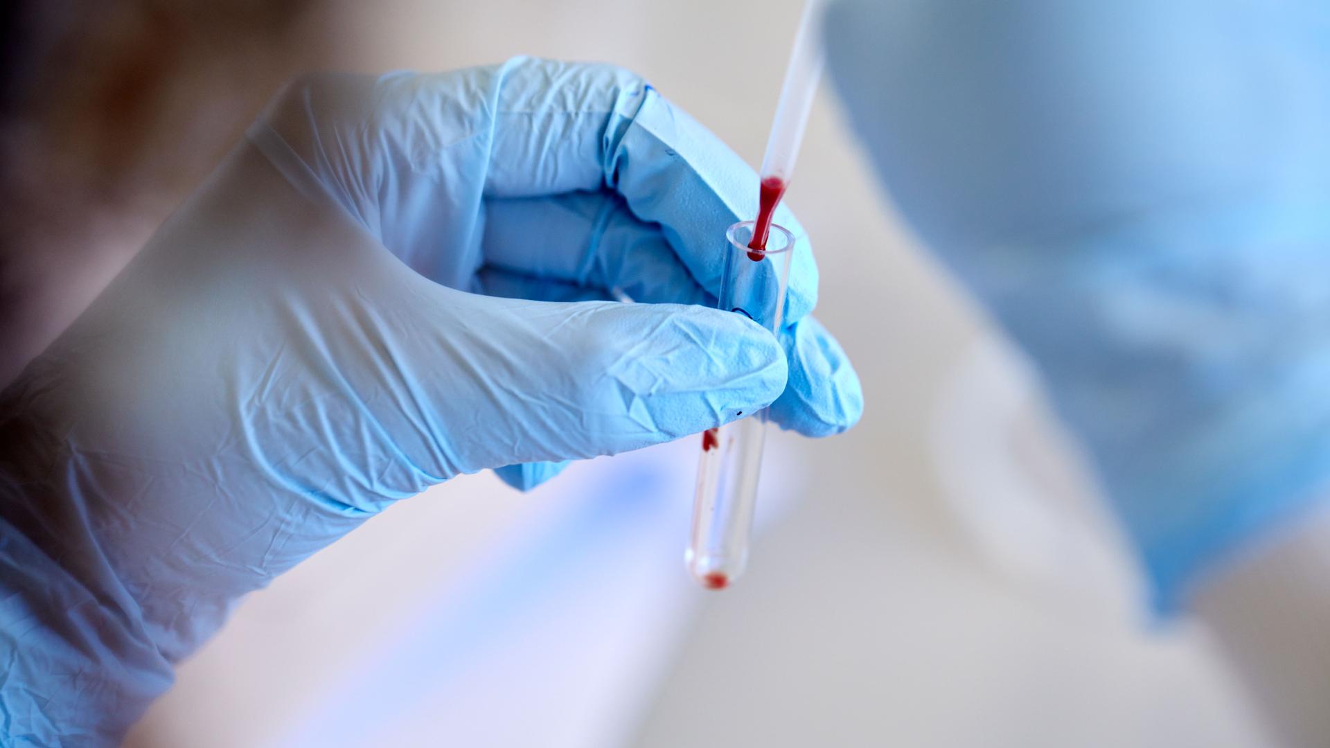 Student working with blood sample in a lab
