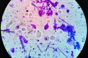 Observation of microbial communities