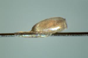 A nit attached to a human hair