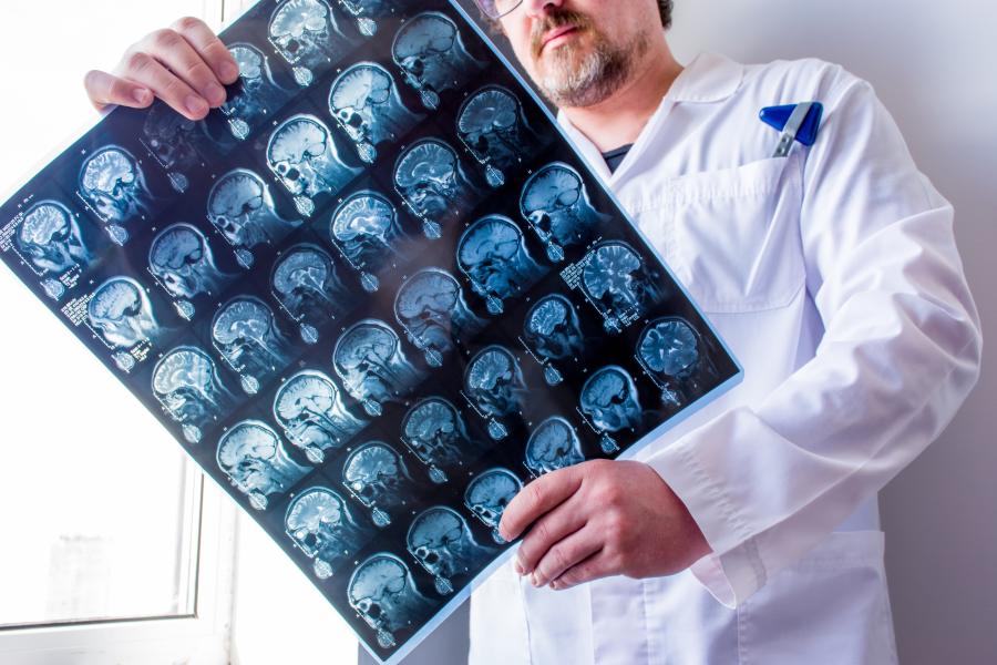 Examining an MRI scan of the head, neck and brain