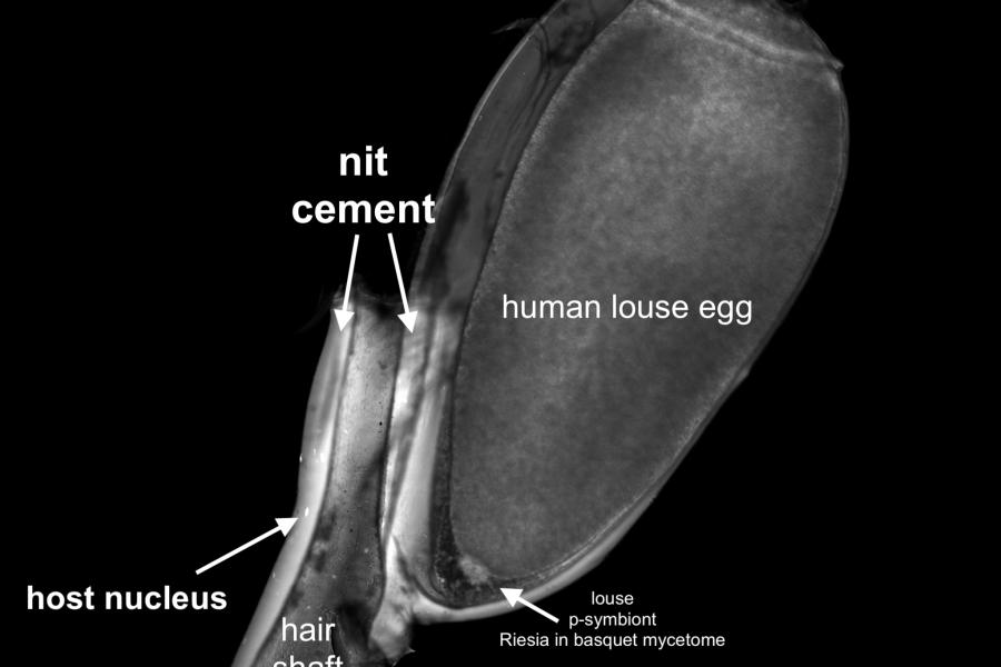 A diagram showing how the cement fixes nits onto a hair shaft.