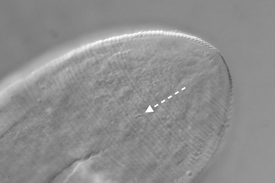icroscope image of the posterior end of the anus of a Demodex folliculorum mite. The presence of an anus on this mite had been wrongly overlooked by some previously, but this study confirmed its presence