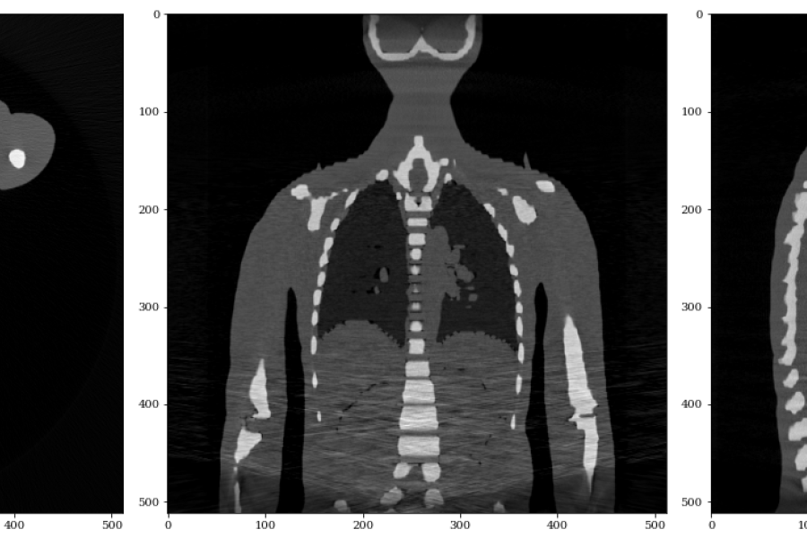 CT images reconstructed using the new data loader linking the images simulated with gVirtualXray and CIL’s reconstruction algorithms.