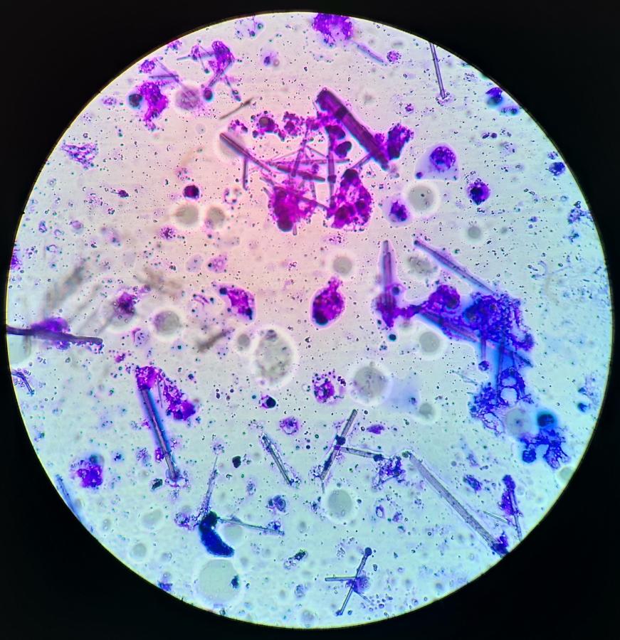 Observation of microbial communities