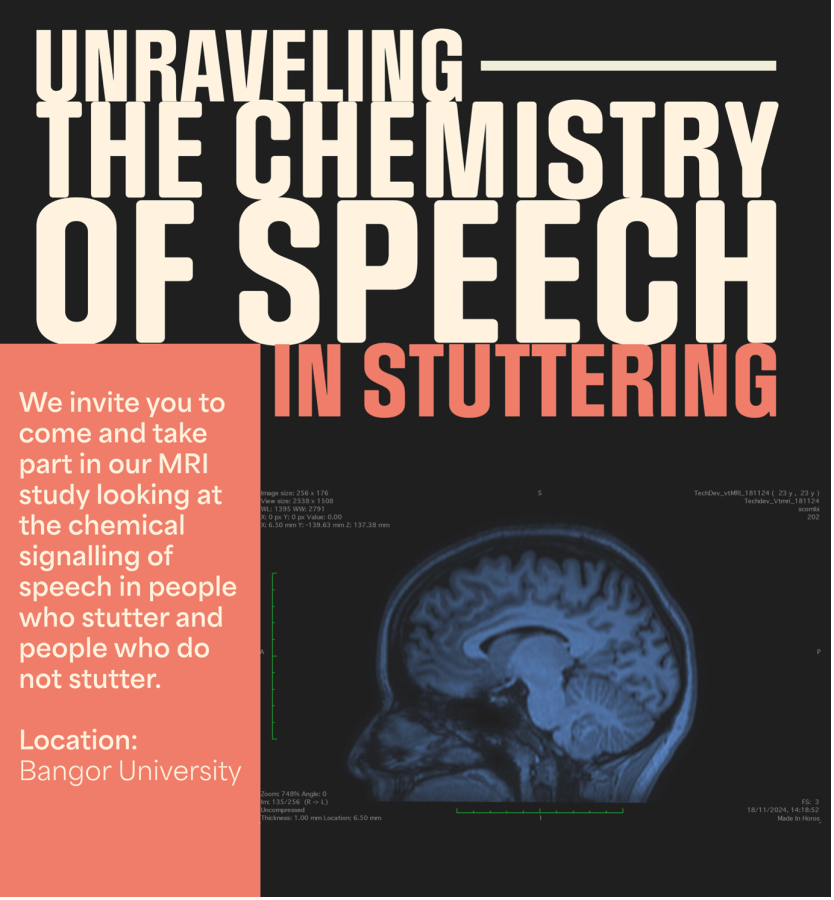 Stuttering Project details: image of brain