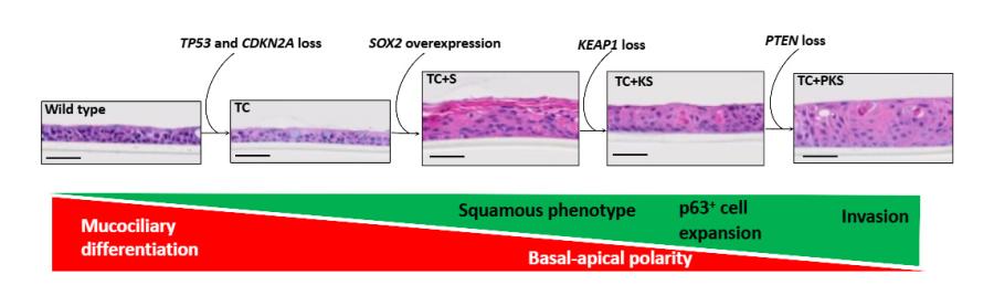 Heamotoxylin-eosin stained sections